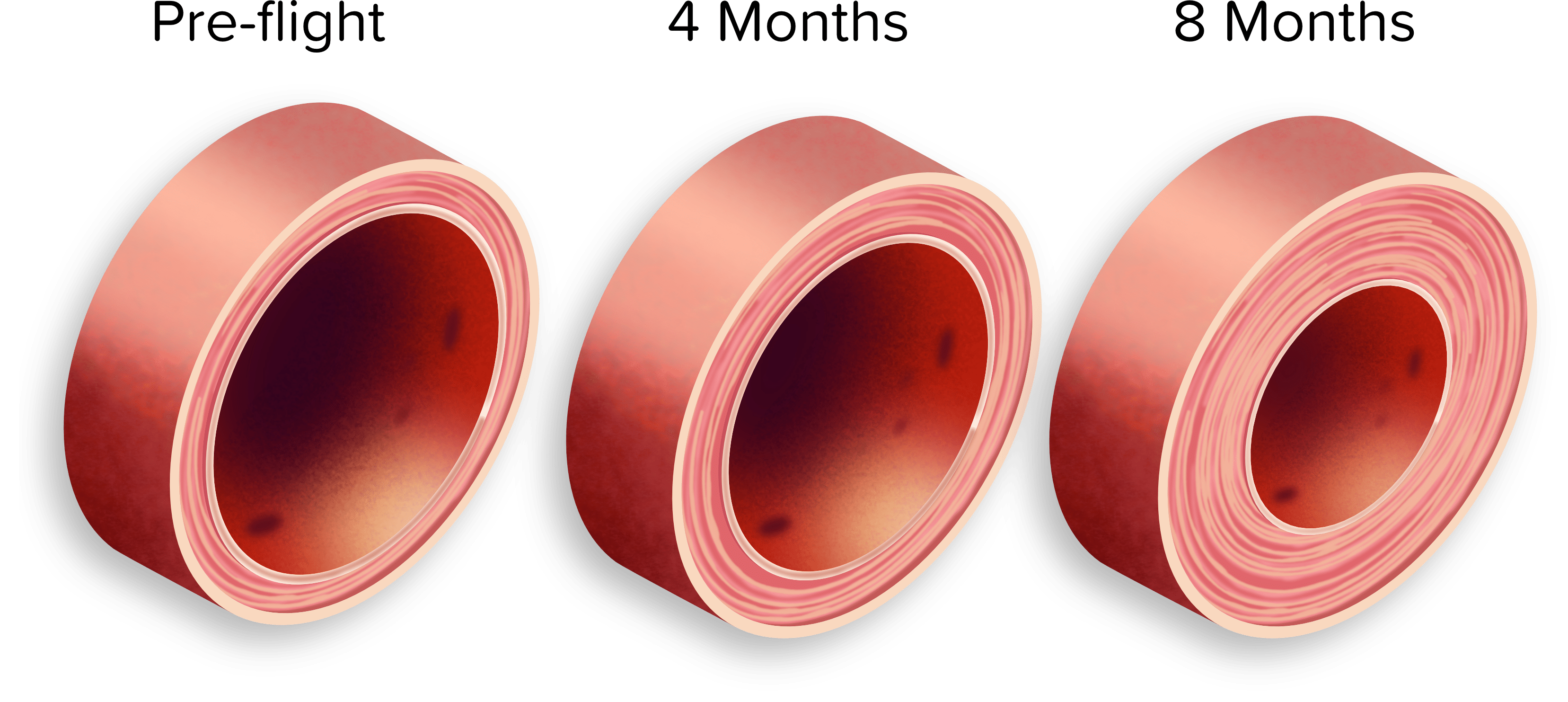 Cardiovascular Imaging