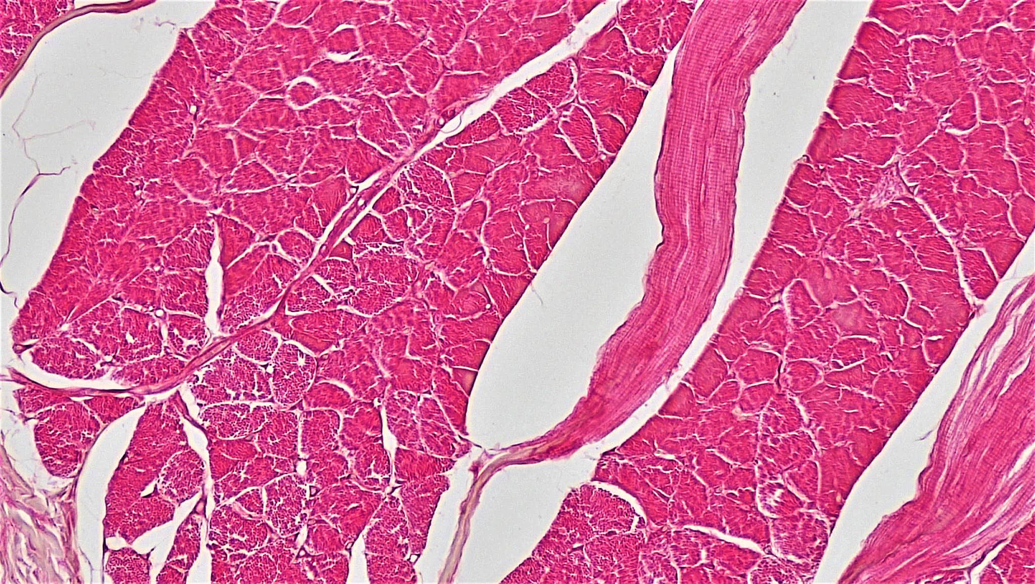 Dillon Muscle Tissue Cross Section whole Skeletal Muscle